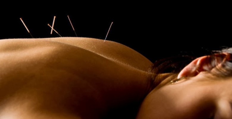 Estudo comprova benefícios da acupuntura após cirurgia de câncer de mama